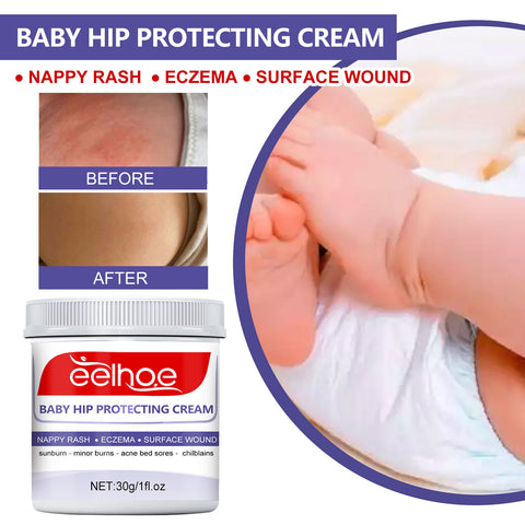 Baby Skin Repair Cream for Hips & Neck